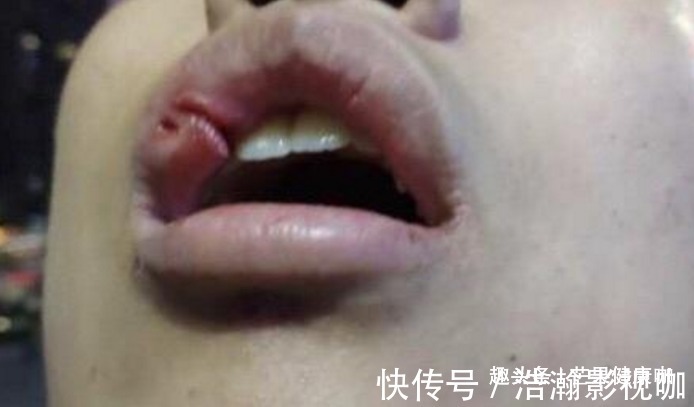 忠告|忠告身体“此处”一旦疼起来，癌症多半已“登场”，别忽视