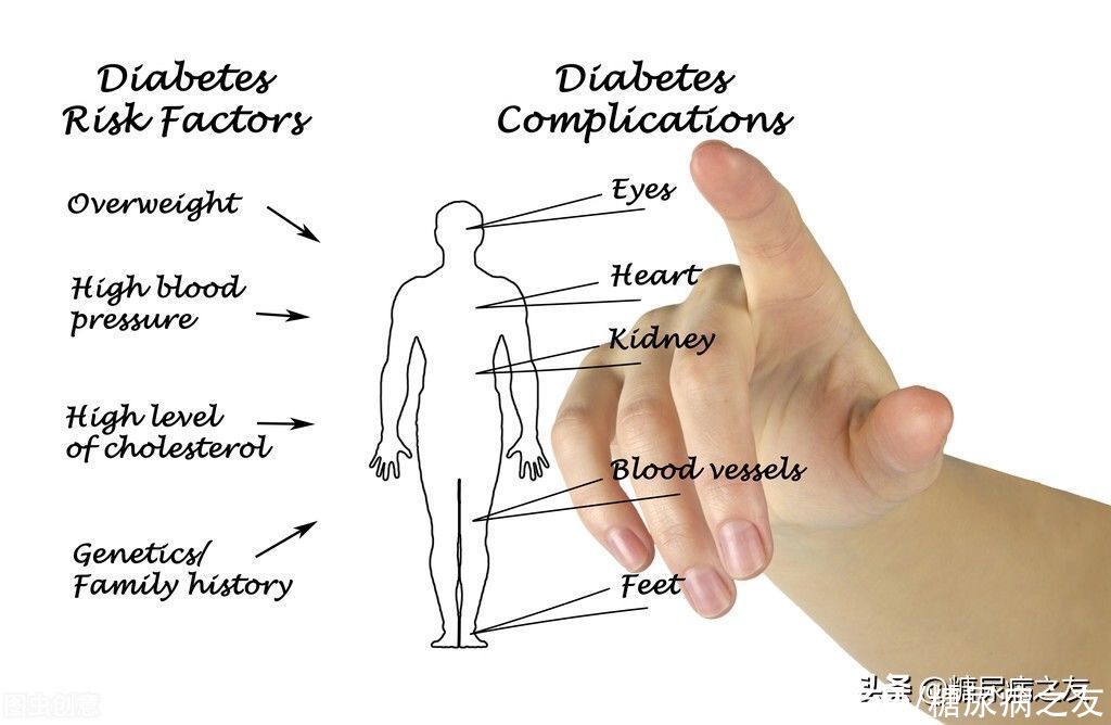 出现这10个症状，可能发生了糖尿病并发症，必须要重视