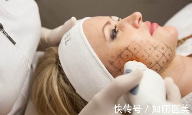 手术 抗衰新星热玛吉原理|热玛吉能维持多久?有没有危险呢?