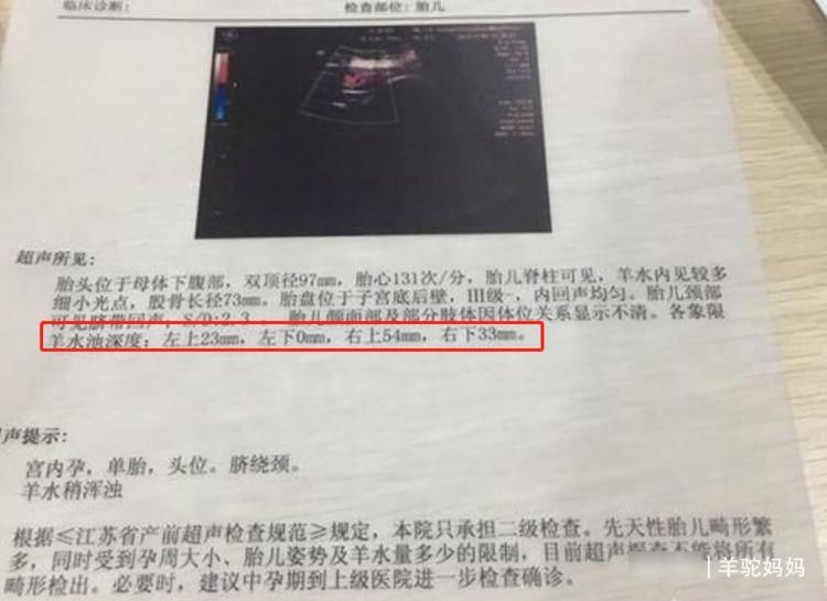 分娩|临近分娩羊水多少合格？产妇要注意产检单上这数字，早了解早受益