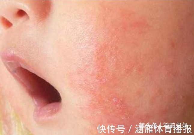 儿科医生|为什么不能给宝宝吃“鸡蛋羹”?儿科医生多次强调,家长要重视