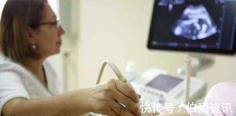 准妈妈|产检大排畸就是四维彩超吗产检你不知道的事儿,准妈妈看过来
