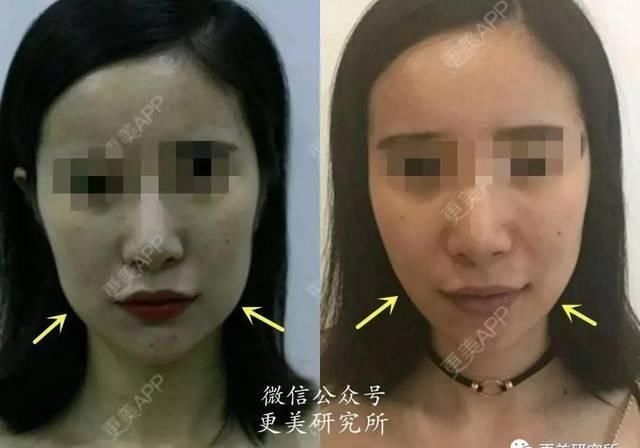 极限|比人间香奈儿还贵的真公主,她突破了人类侧脸美极限
