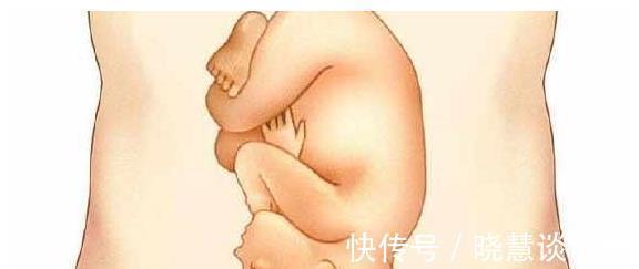 胎儿|胎儿什么时间“入盆”最好,孕妈经常保持这个姿势会影响胎儿入盆