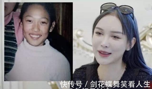 整容手术 14岁时,我接受了母亲的治疗,我花了400万美元进行整形手术!