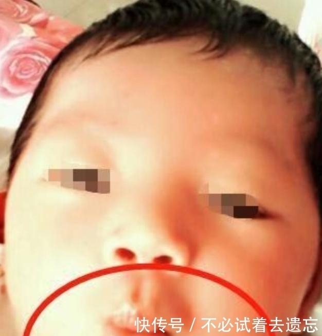 不以为然|3岁女儿撅“金鱼嘴”，妈妈不以为然夸可爱，奶奶却抱娃直奔医院