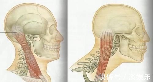 克星|颈椎病的克星:聊聊颈椎那些事,让颈椎病从此和你说拜拜!