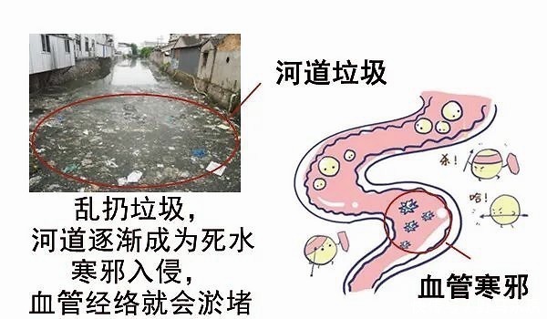 元气|大白话说中医第一百一十八期体寒肝虚要抓主因,先调便秘全身受益!