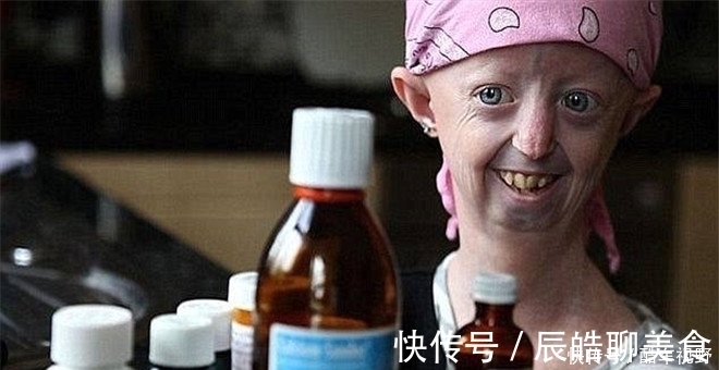 遗传病|七岁宝宝得了这种怪病，却不哭不闹帮妈妈照顾弟妹，疼痛时想睡觉