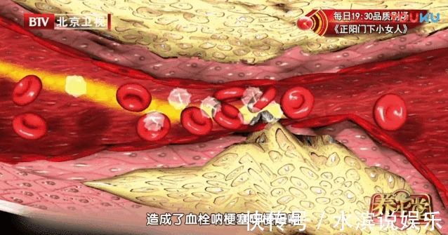 心血管疾病|黄芪加它，九月开始喝，活血化瘀护心脏！老中医每天一杯