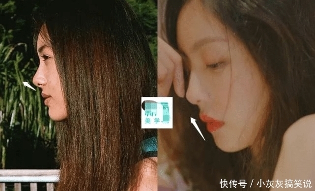 优越鼻型精细化到山根的宽窄？对颜值影响还真大