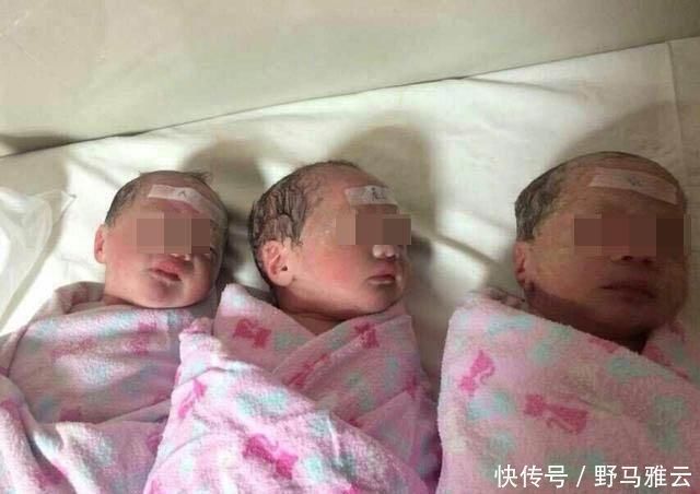 二胎政策|生下双胞胎后,产妇却大喊“等一下”,医生检查后,发现意外惊喜