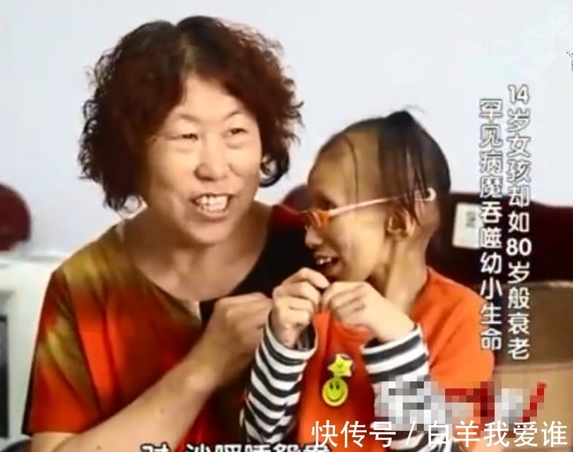 女孩|14岁女孩像80岁老人,做完手术的1句话,让医生父母纷纷落泪