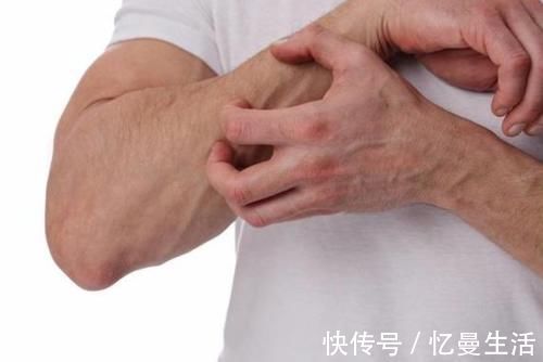 毒性|检查出肺癌，到底要不要化疗？化疗药有哪些？