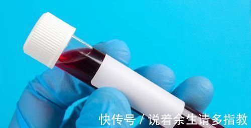 前列腺增生|前列腺有癌,小便先知,排尿若出现三个特征,最好去检查PSA