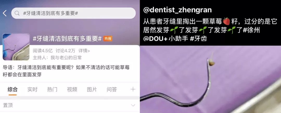 冲牙器|抠牙为什么会这么臭?原来都是它在作怪.....