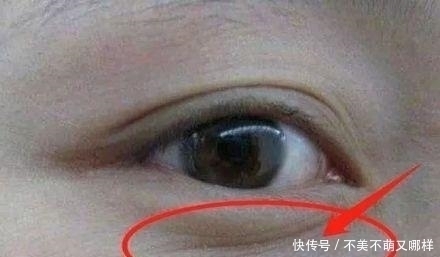 毒素|子宫健康的女性,脸上不会有4种表现,常喝1种水,子宫更光滑