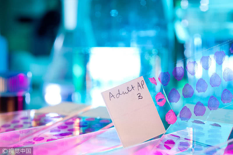 预防中风|每天“踮脚”15分钟,一段时间后,4个“问题”悄悄溜走了