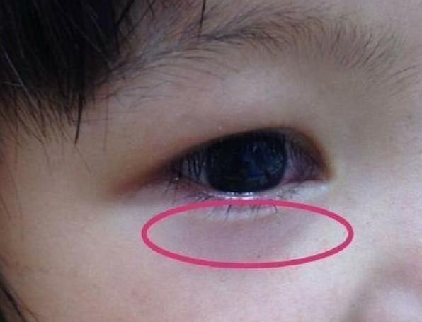 孩子|姥姥带双胞胎5年,很少往医院跑,分享:常做3事,别让娃积食