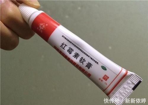 红霉素眼膏|2块钱一支的红霉素软膏，居然还有这3个功效，知道的人少之又少