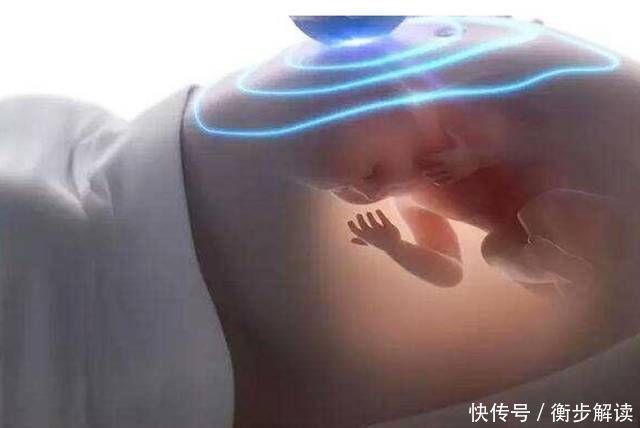 先破水的是男孩？医生：和性别无关，暗示了胎儿的发育好坏