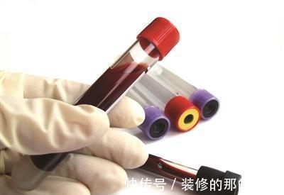 甘油三酯|高血脂的人适合做什么运动?什么时间效果最好,对运动有何要求?