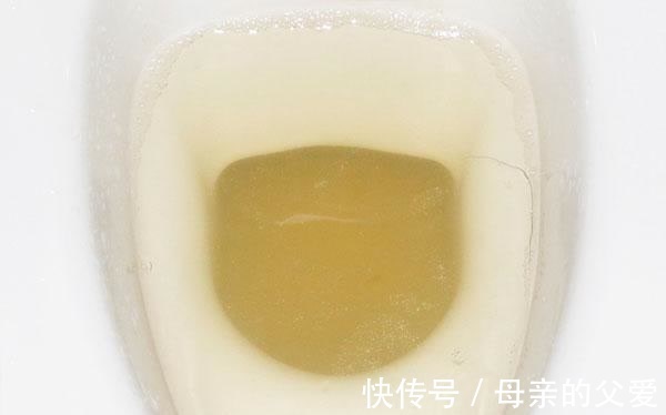 肝脏|肝不好的人,身体可能会出现“怪象”,常吃二物,或可有助改善