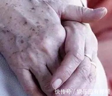 白色|人老后会有老年斑？营养专家忠言：吃2种白色食物帮你消除