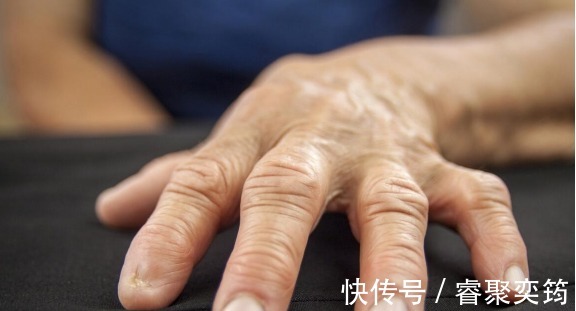 异常|头部出现3种异常，肺脏或已奄奄一息，发现其一，养肺不能再拖