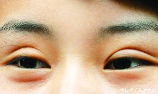 女神|有这3种眼型的女生，基本与女神颜值无缘了，很多人都是第1种