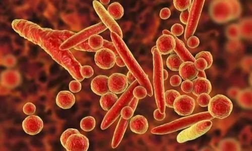 张女士|这1物吃一次相当于10斤苦瓜,内科主任:你若爱吃,胰岛会很高兴