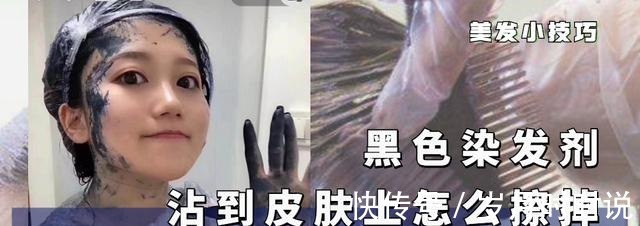 皮肤 黑色染发剂沾在皮肤上如何洗掉三个小妙招,轻松擦掉染发痕迹!