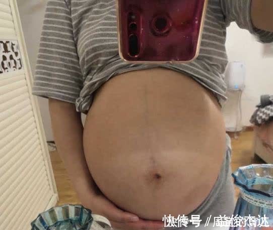 准妈妈|晚孕肚子痒,可能暗示这一征兆,准妈妈别疏忽