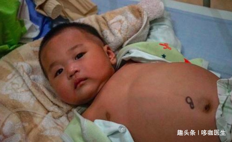 骨肉瘤|专家提醒儿童也会发生恶性肿瘤，家长要留心孩子这些方面的改变