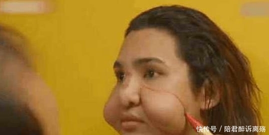 整容手术|三姐妹做整容手术只花100元,结果令她们后悔不已