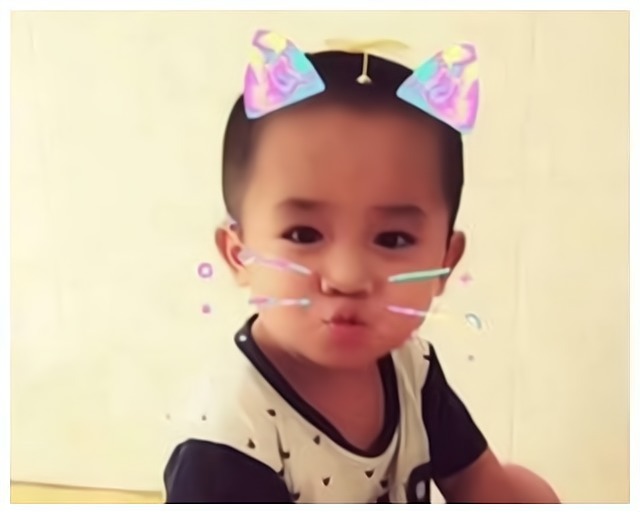 宝妈|5年前因吃奶太用力,婴儿被母亲用剪刀“划伤”脸,如今咋样了