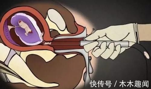 废物|那些被打掉的“胎儿”们,最后都到哪儿去了呢?