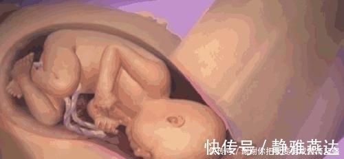 分娩|临产前胎宝忙得不可开交，为了跟妈妈见面，胎宝默默承担了这么多