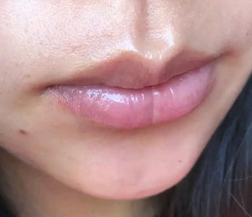 这4个坏习惯，会让女生的嘴唇越来越丑！你也有的话，尽量改掉吧