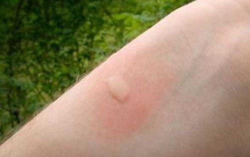 花露水|中国货又火了,在澳洲商店街中被抢购一空,直言实在太好用了