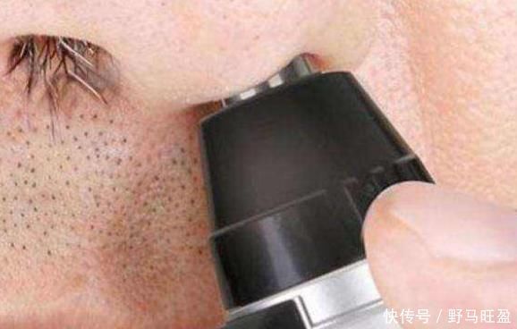 衰老|鼻毛为何会变白?八成与此3个原因有关,大多数人还不清楚