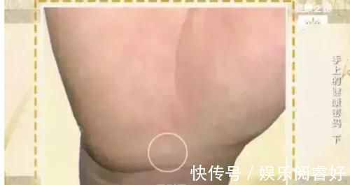 生命线|观手知健康!快速辨识高血压、高血糖就这么看,2分钟学会!