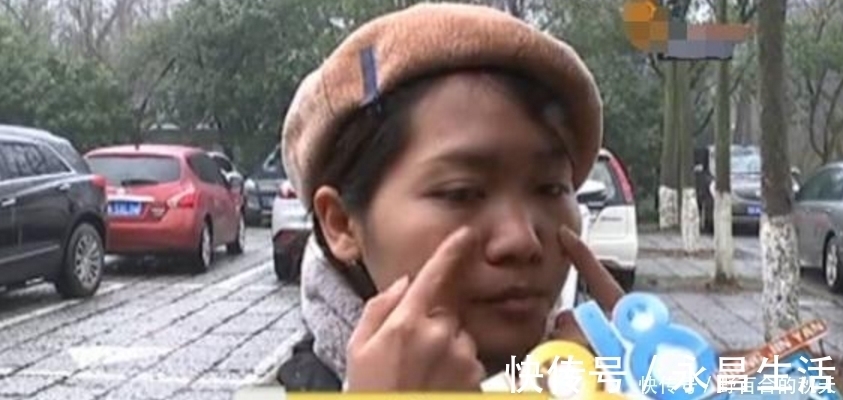 太阳穴|瘦脸后被同事说老了,女子找整形医院退钱,医生:每个人底子不同