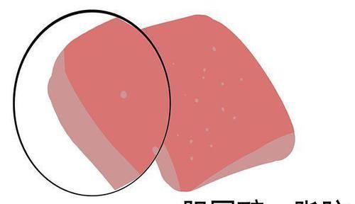 早上|胆固醇偏高,每天早上吃一颗鸡蛋,胆固醇会降还是会升答案来了