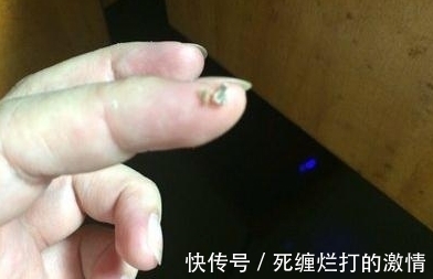 医院|男孩因口臭被孤立,爸爸带到医院去检查,张嘴后医生都吐了