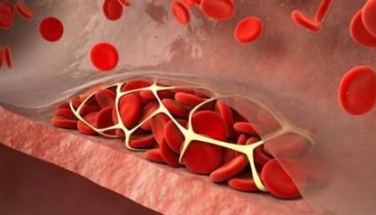 山楂|这2种食物清理血管“有一手”,应该经常吃,便宜又方便