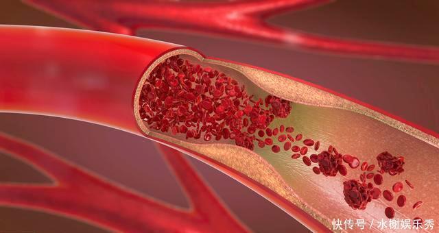 寿命|50岁,是寿命“决定期”,若身体有5个表现,恭喜是长寿体质