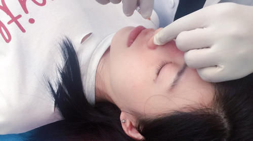 玻尿酸|玻尿酸注射一半,医生要求加3000再打一针?女子:把我当猪宰