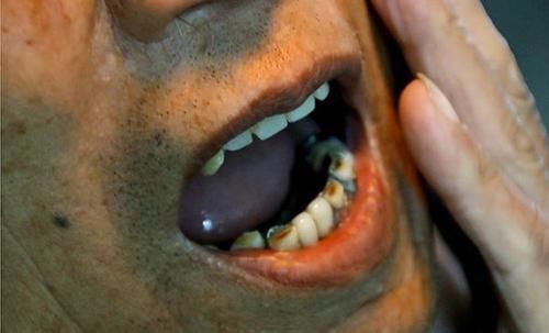 常吃核桃,好处比较多,医生却说:3种人吃了对身体并不好