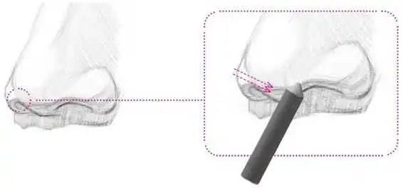 零基础素描教程：分步骤讲解3/4侧面鼻子画法，简单易学，快临摹